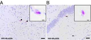 Figure 1 from Leibovitch (2018)