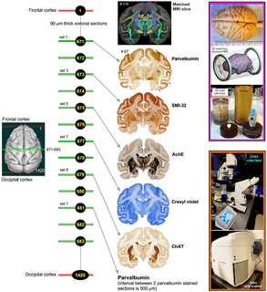Figure 1 from Saleem (2021)